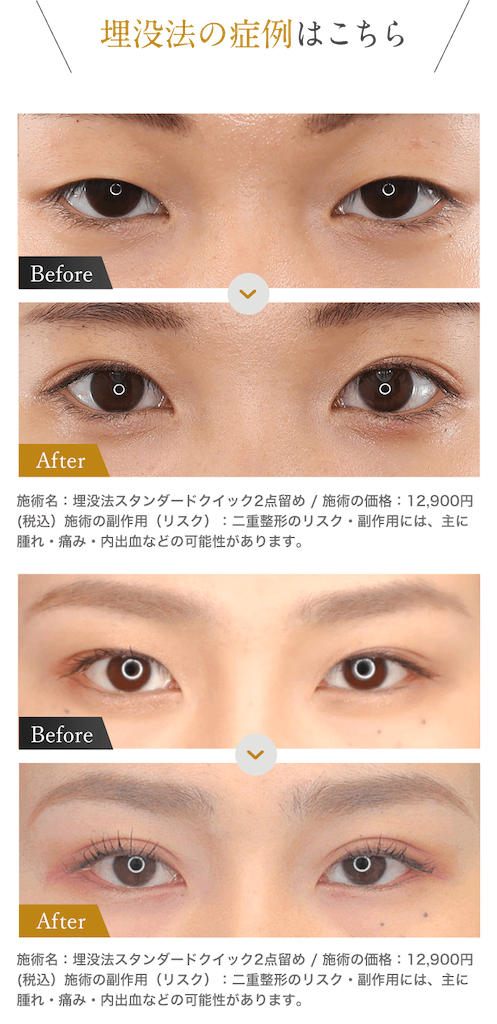 f:id:kentaro0423:20211207182702p:image f:id:kentaro0423:20211207182702p:image