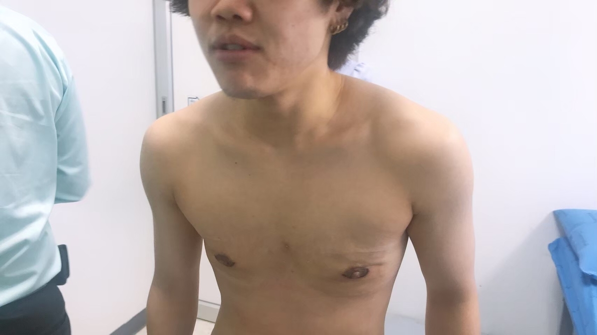 Ftmタイsrs記録 10日目 最終検査通院 るいみー 井上健斗 公式ブログ