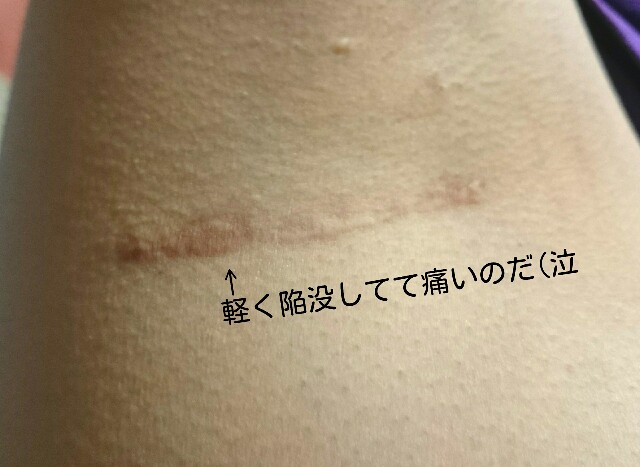 f:id:keroro06:20160318201814j:image f:id:keroro06:20160318201814j:image