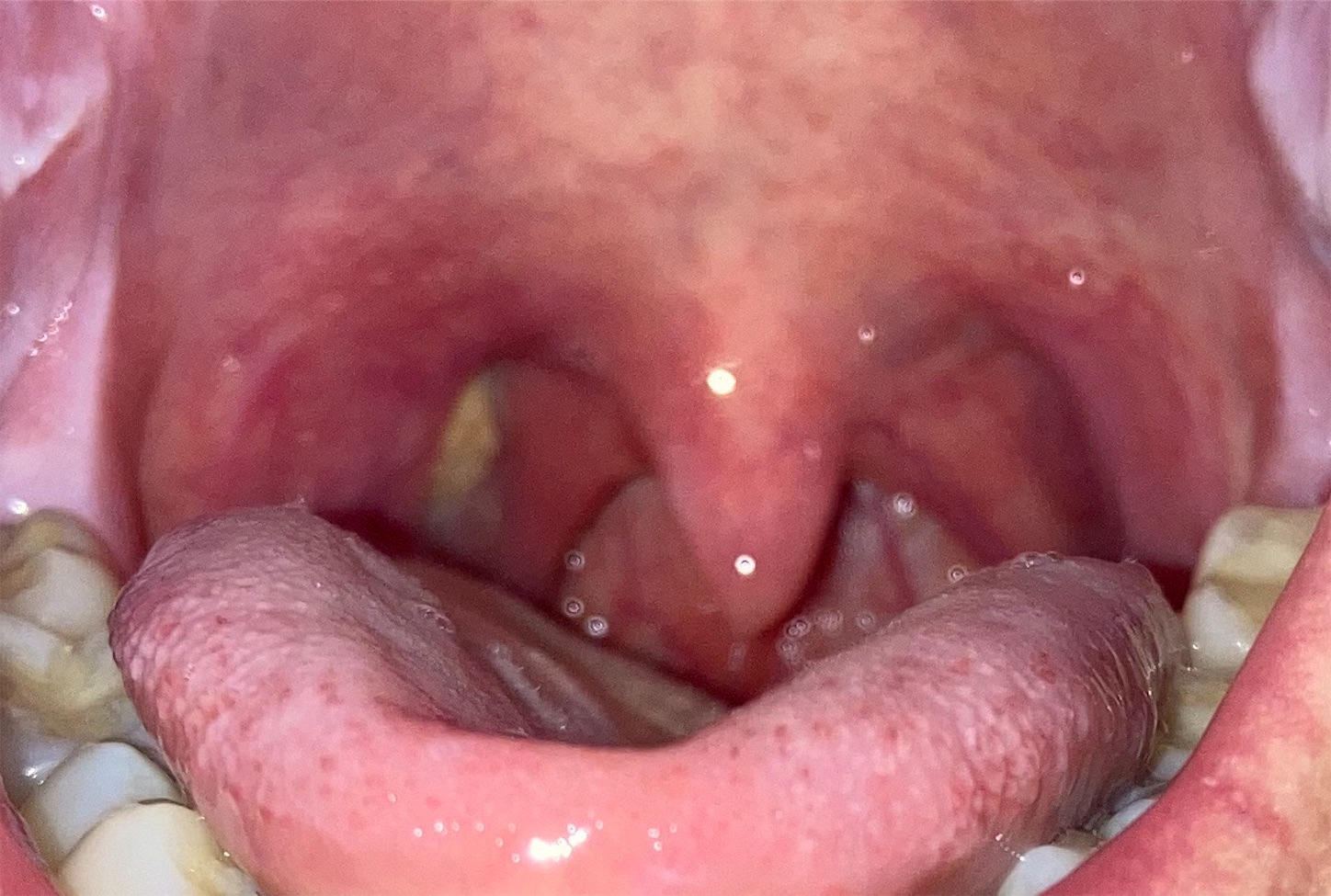 f:id:ketoraaa:20200723113021j:image f:id:ketoraaa:20200723113021j:image