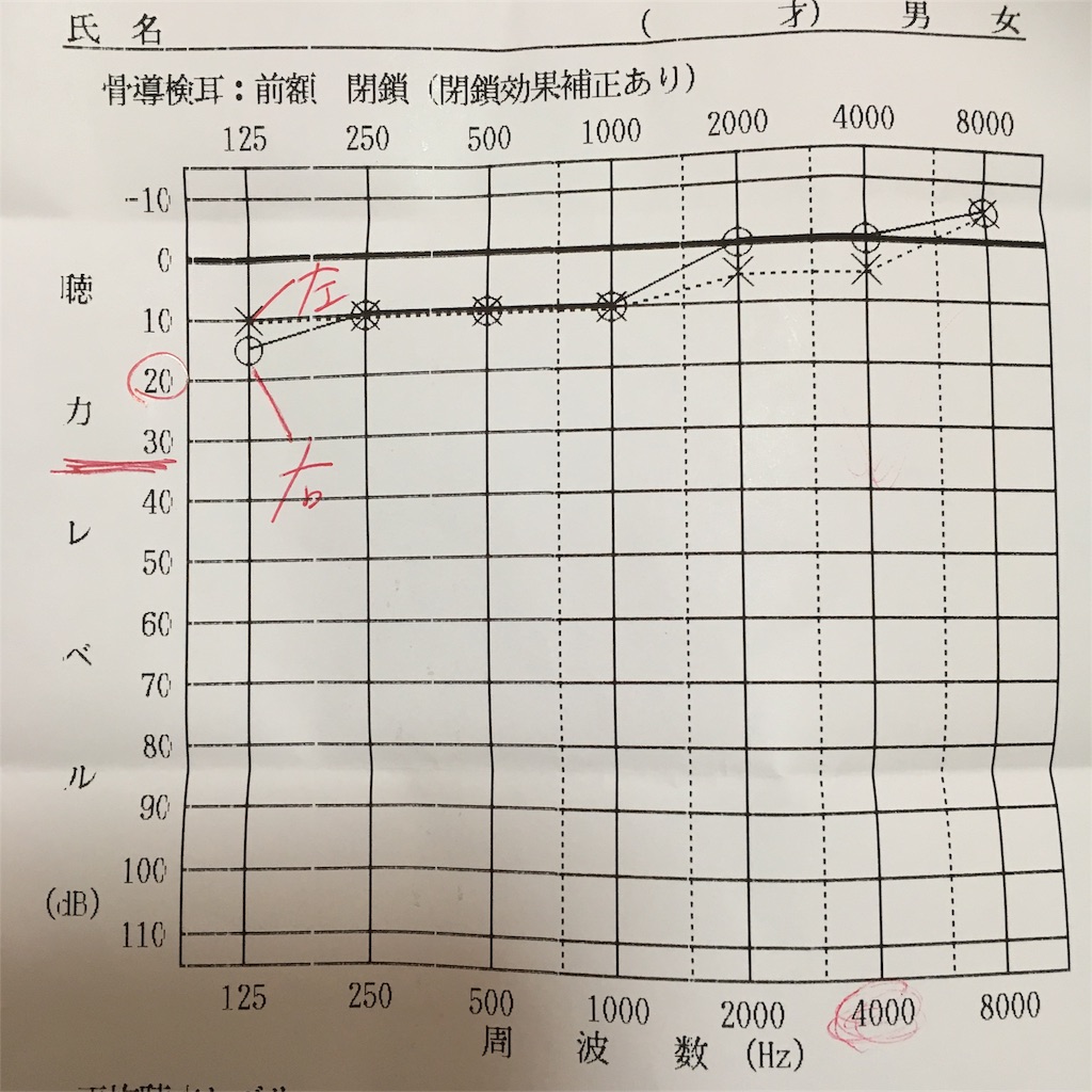 f:id:khkk1207:20180219133754j:image f:id:khkk1207:20180219133754j:image