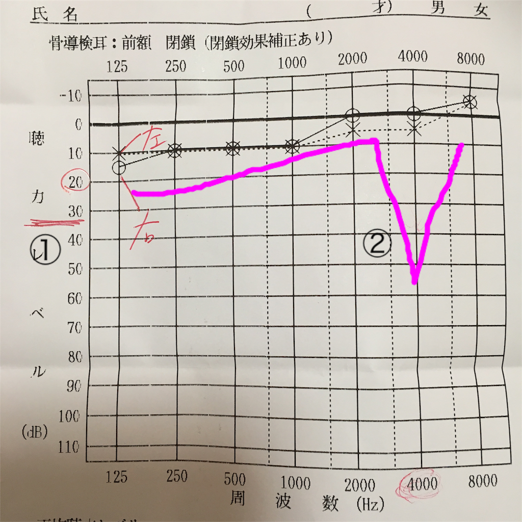 f:id:khkk1207:20180219220320p:image f:id:khkk1207:20180219220320p:image