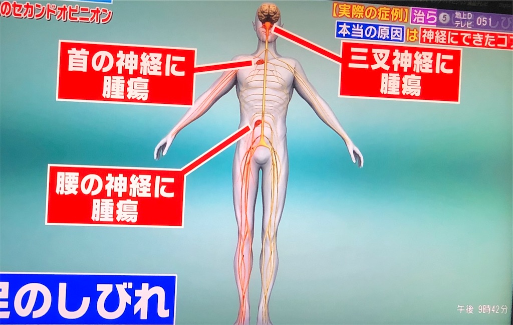 f:id:ki-kochan:20190910210949j:image