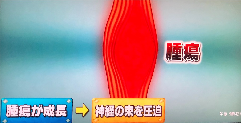 f:id:ki-kochan:20190910210952j:image