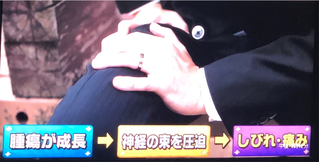 f:id:ki-kochan:20190910210957j:image
