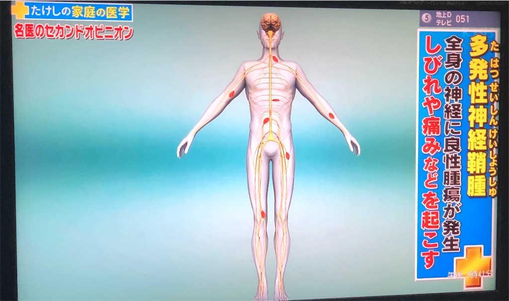 f:id:ki-kochan:20190910211017j:image