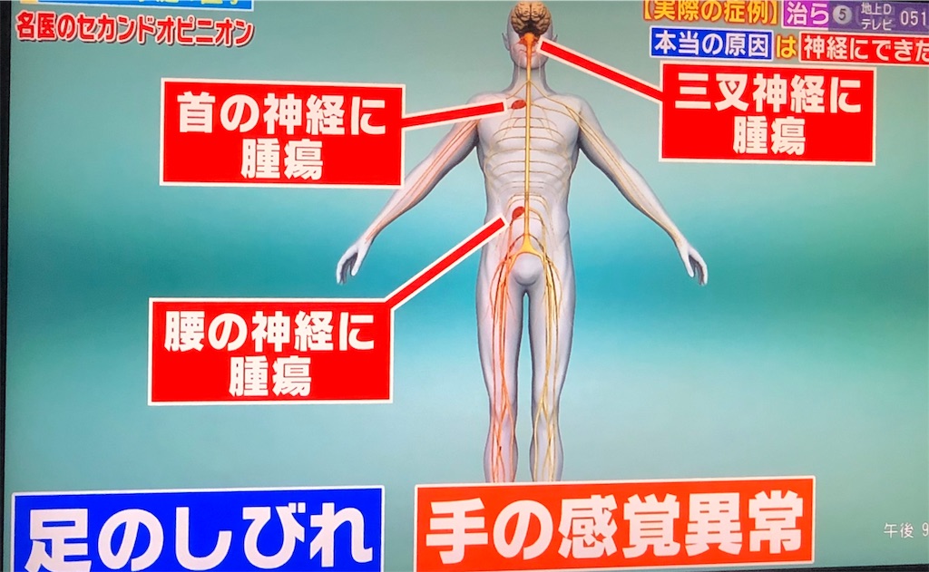 f:id:ki-kochan:20190910211038j:image