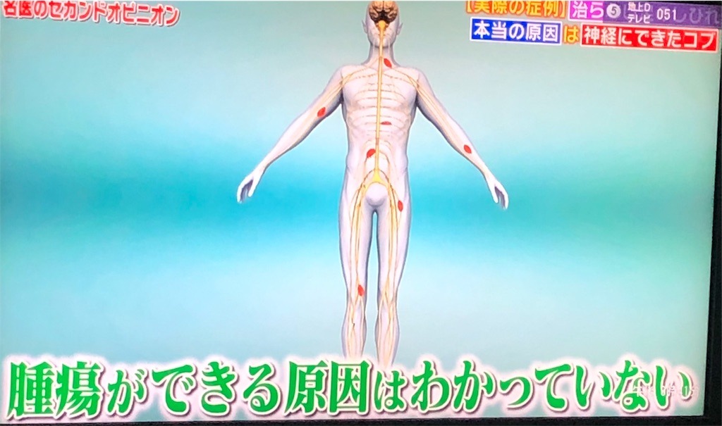 f:id:ki-kochan:20190910211044j:image