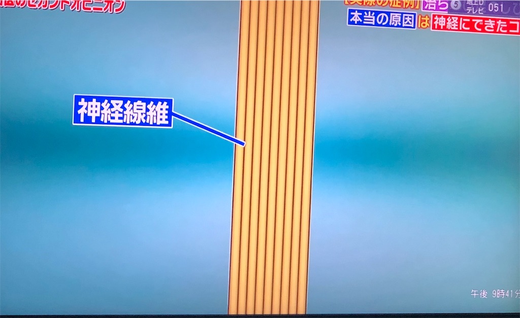 f:id:ki-kochan:20190910211046j:image