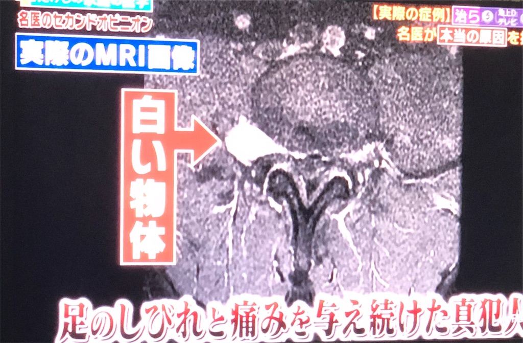 f:id:ki-kochan:20190910211118j:image