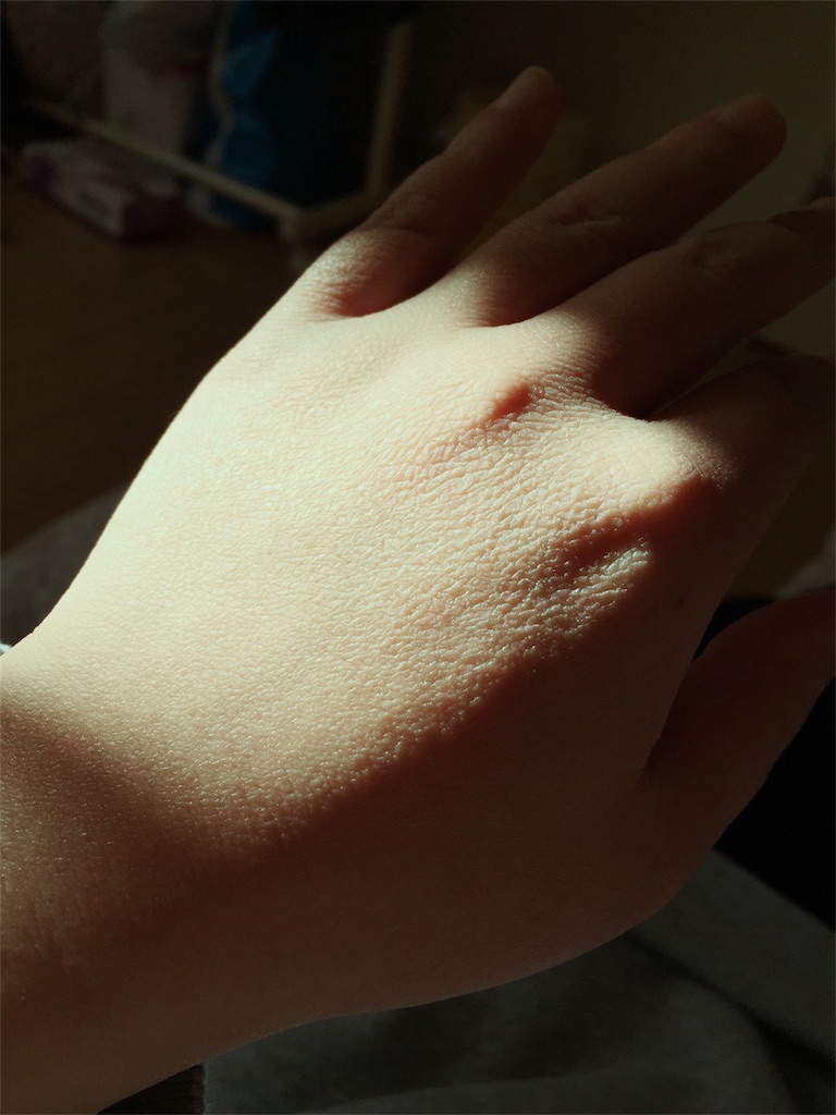 f:id:kidskind:20180311211640j:image