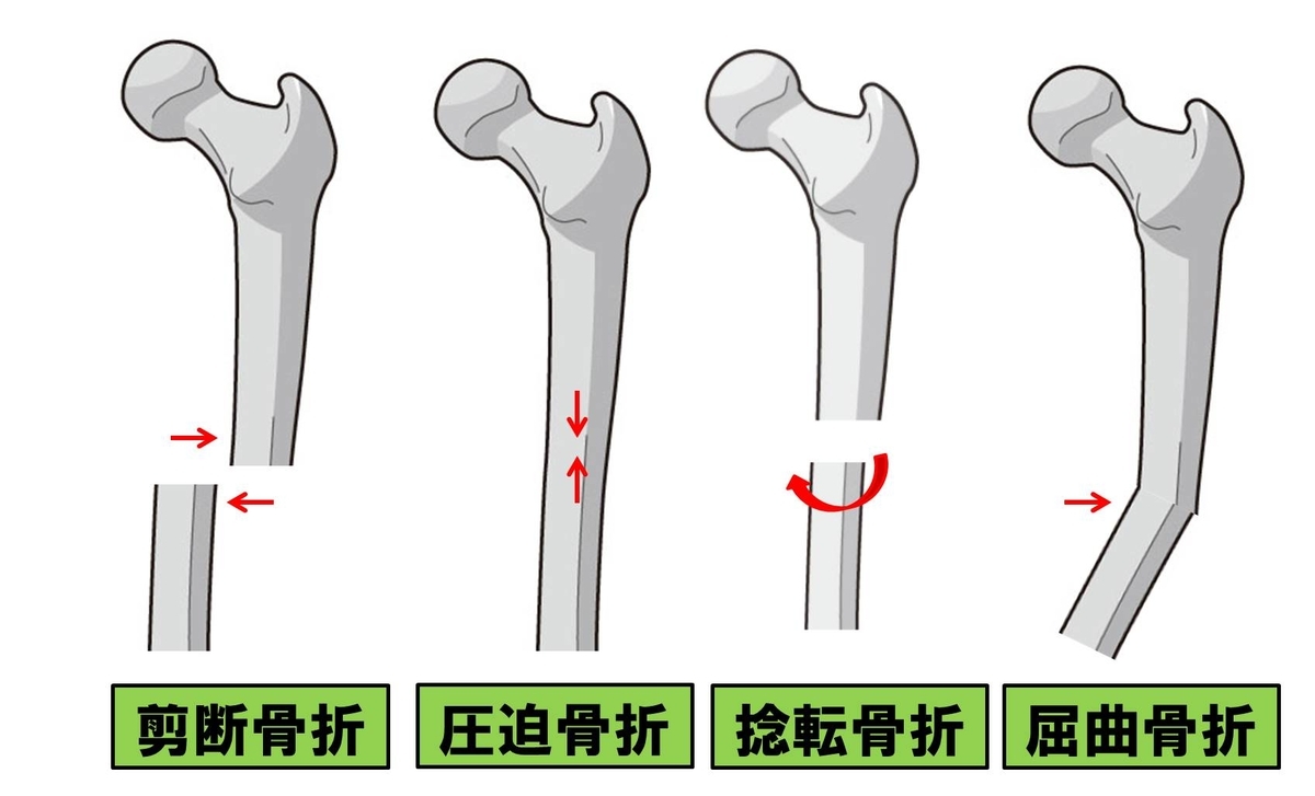 f:id:kigyou-pt:20210303084906j:plain