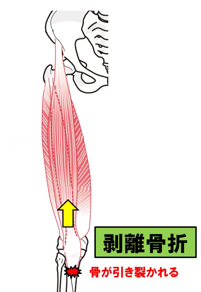 f:id:kigyou-pt:20210303084920j:plain