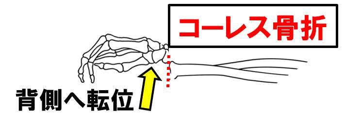 f:id:kigyou-pt:20210312082514j:plain