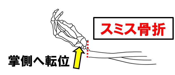 f:id:kigyou-pt:20210312082630j:plain