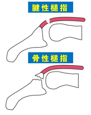 f:id:kigyou-pt:20210514085424j:plain