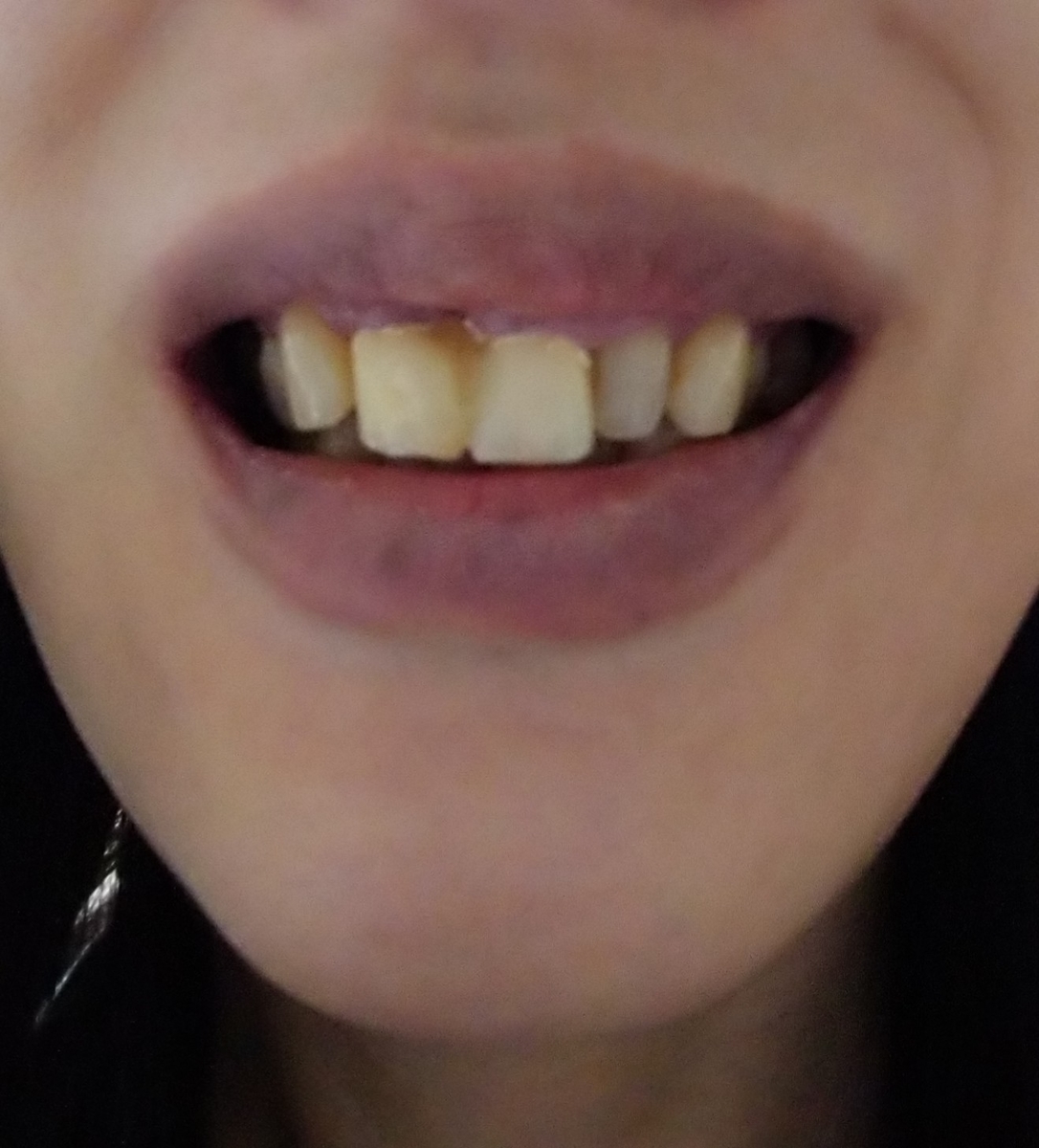 f:id:kiiro-siro:20200525094143j:plain