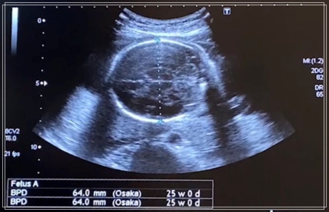 f:id:kikkin1989:20210722123213j:plain