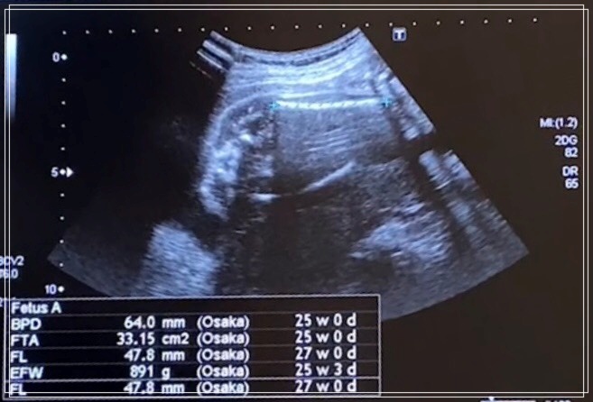 f:id:kikkin1989:20210722123247j:plain