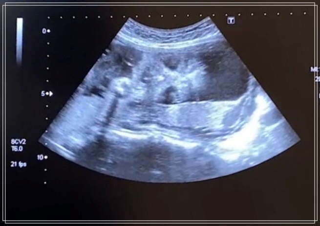 f:id:kikkin1989:20210722123327j:plain