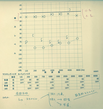 いらねえ情報短信 突発性難聴だってさー キクチヒロシ ブログ