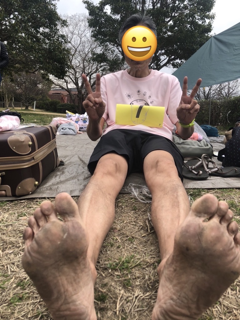 大濠公園で、裸足フルマラソン。足裏は大丈夫