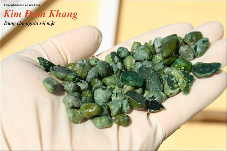 f:id:kimdomkhang:20211022183109j:plain