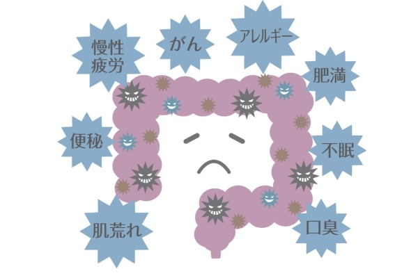 便秘とは