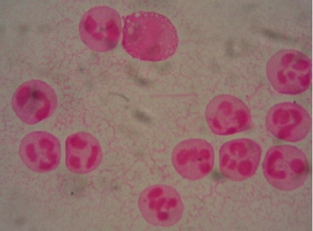 個別 尿酸結晶 の写真 画像 Kisaragi5 S Fotolife