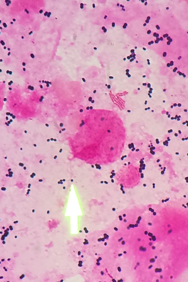 f:id:kisaragi5:20161208142126j:plain