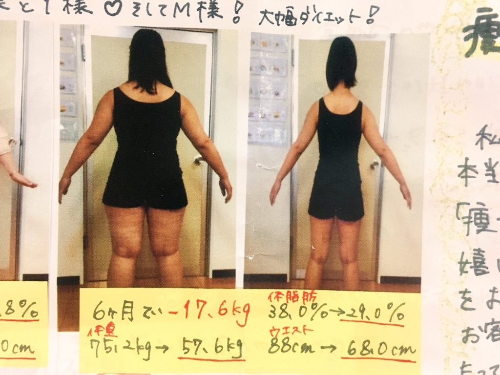 f:id:kisokoji:20170829141859j:plain:w300