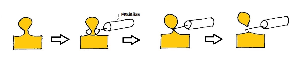 f:id:kite-cafe:20210915080318j:plain