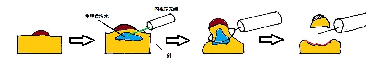 f:id:kite-cafe:20210915080344j:plain