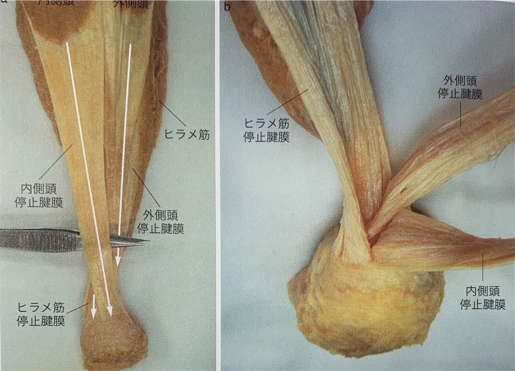 f:id:kiteibu:20201026100741j:image