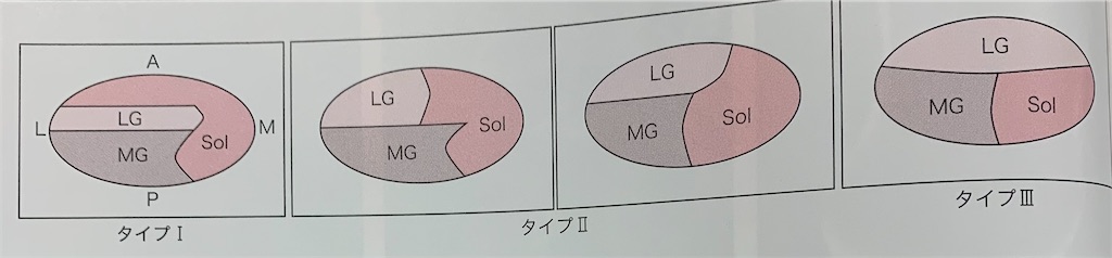 f:id:kiteibu:20201103170524j:image