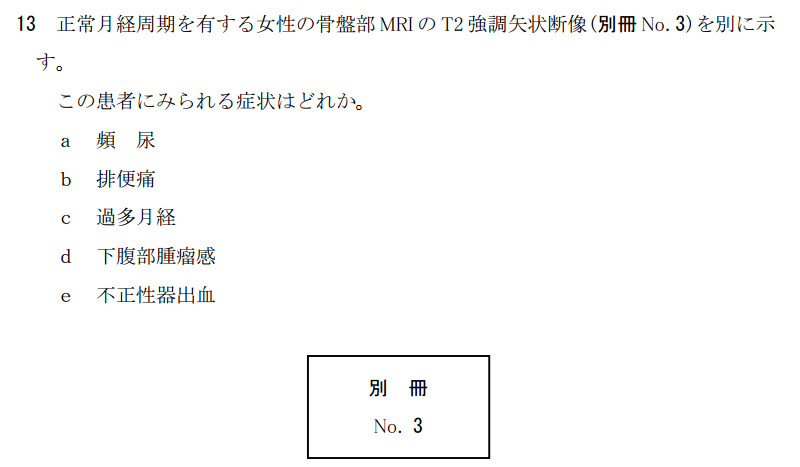 f:id:kmshzr_im:20170124220434j:plain f:id:kmshzr_im:20170124220434j:plain