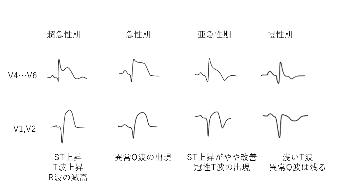 f:id:kodomonotsukai:20210807212334p:plain