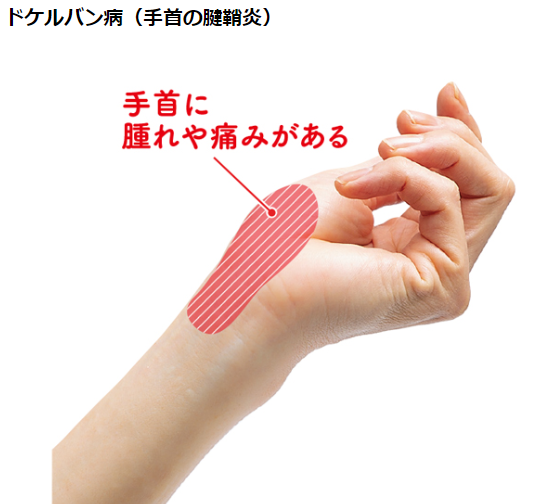 f:id:koizumitougouiryou:20190912173905p:plain f:id:koizumitougouiryou:20190912173905p:plain