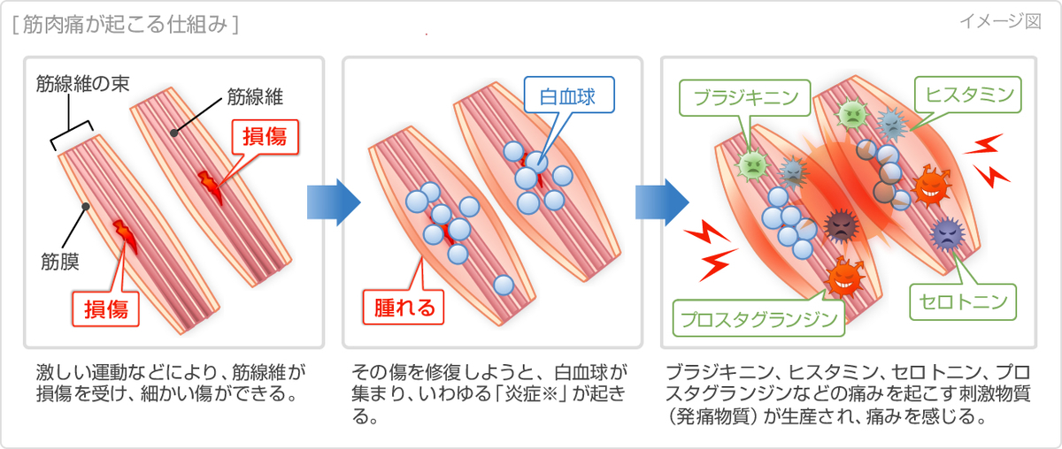 f:id:kokiyama:20190320133842j:plain