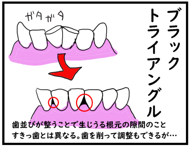 f:id:kokkoco:20210609212630p:plain