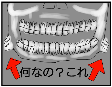 f:id:kokkoco:20210612223327p:plain