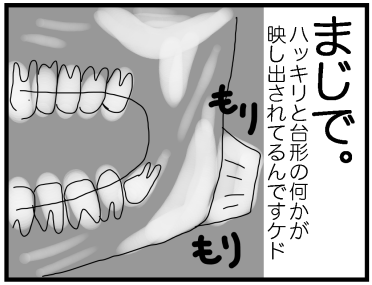 f:id:kokkoco:20210612223344p:plain