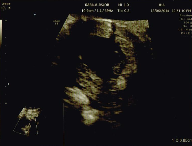 妊娠超初期 初期の体験談 安定期までに気を付けたいこと 新米ママの子育て 育児ブログ