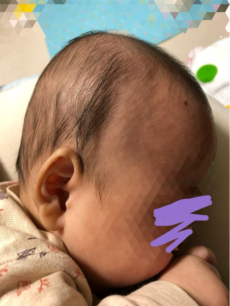 赤ちゃんの薄毛って治る 1歳になっても薄毛 でも大丈夫 こんぶままの双子育児中のまったりブログ