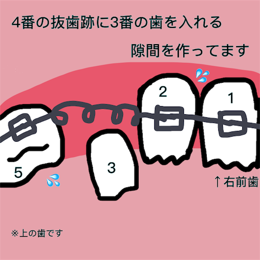 f:id:konmama:20180128131647p:image f:id:konmama:20180128131647p:image