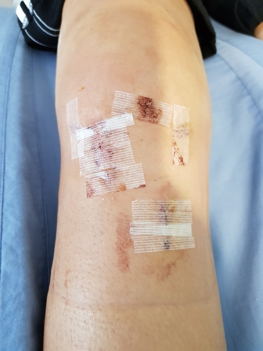 f:id:kopanda2018:20190723072754j:plain