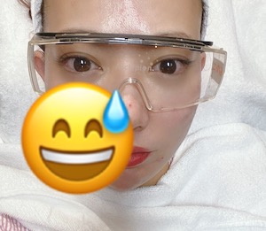 ラミチェ皮膚科 レポ