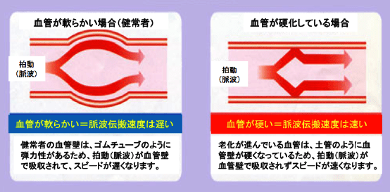 f:id:korekai:20170411140829p:plain f:id:korekai:20170411140829p:plain