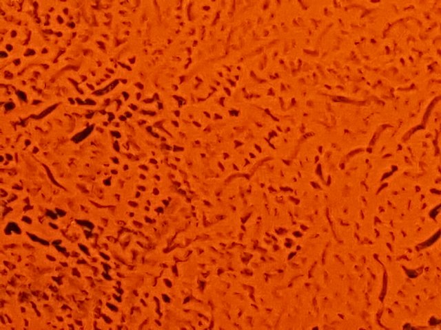 f:id:korokoroblog:20170512044755j:plain