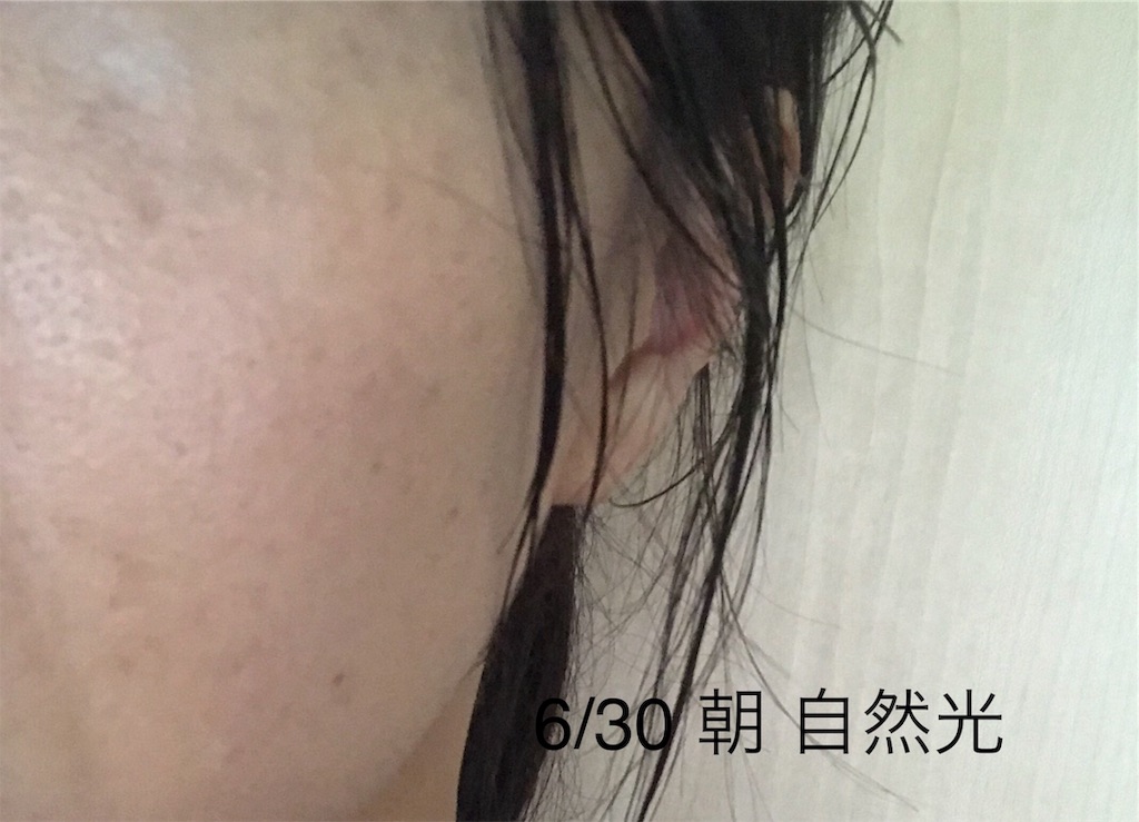 f:id:koshikakeol:20190702184307j:image f:id:koshikakeol:20190702184307j:image